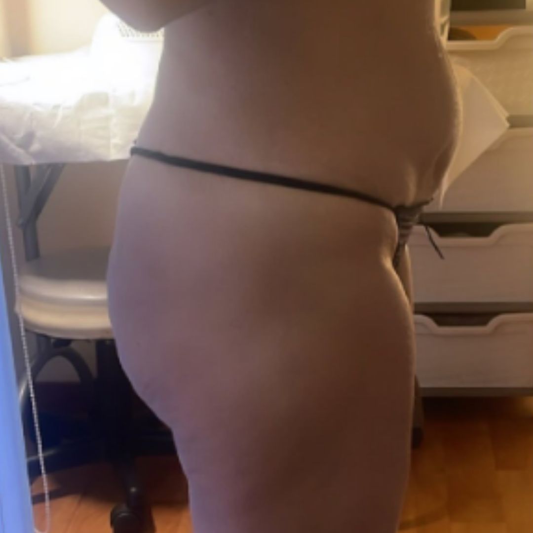After image