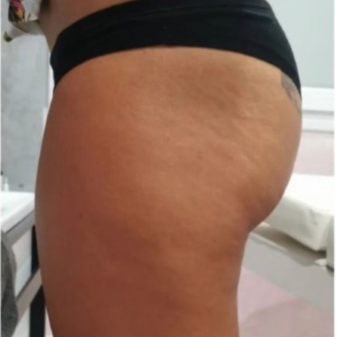 After image