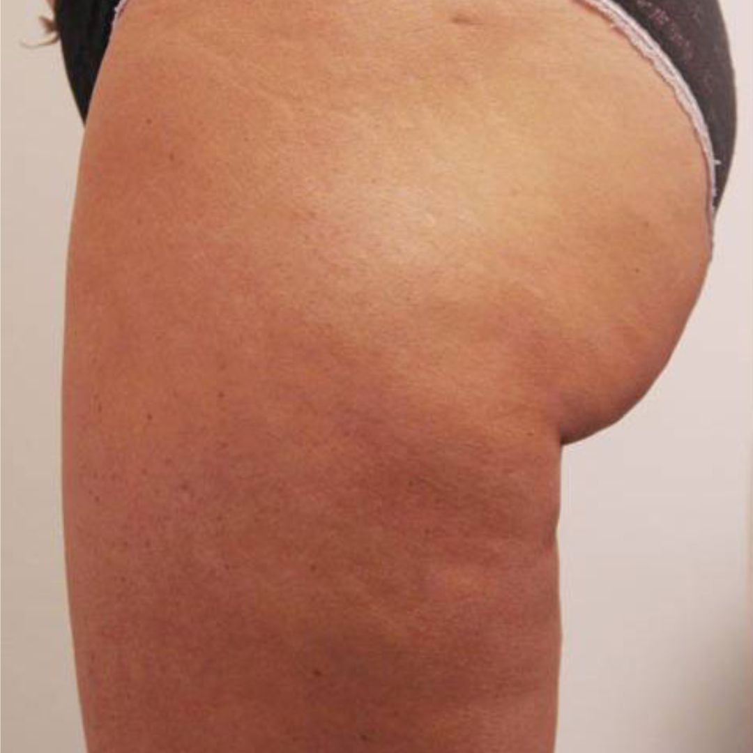 After image