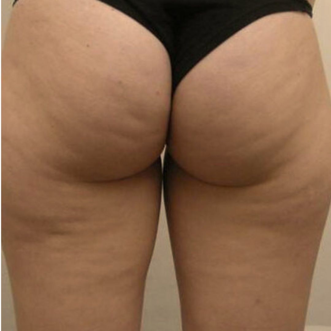 Before image